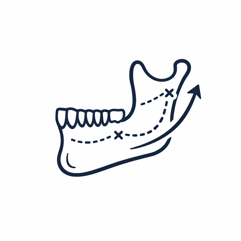 Jaw Correction Surgery